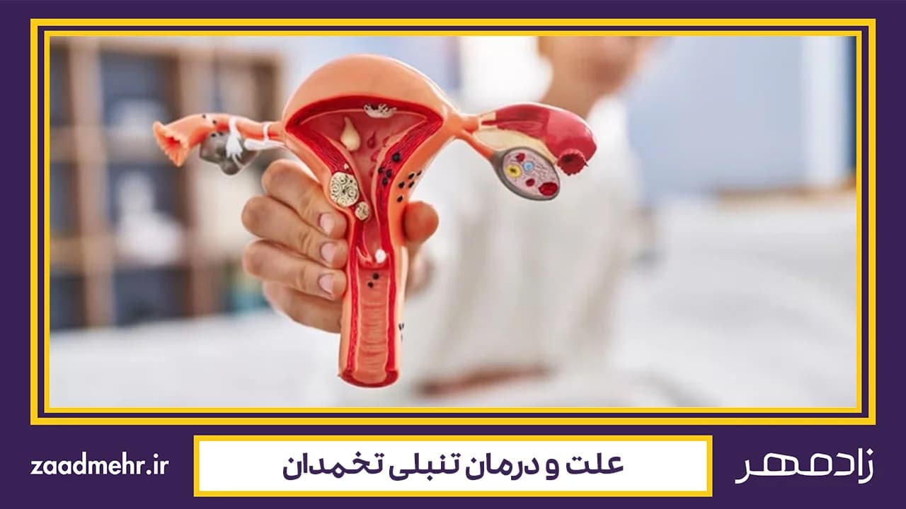 علت و درمان تنبلی تخمدان چیست؟