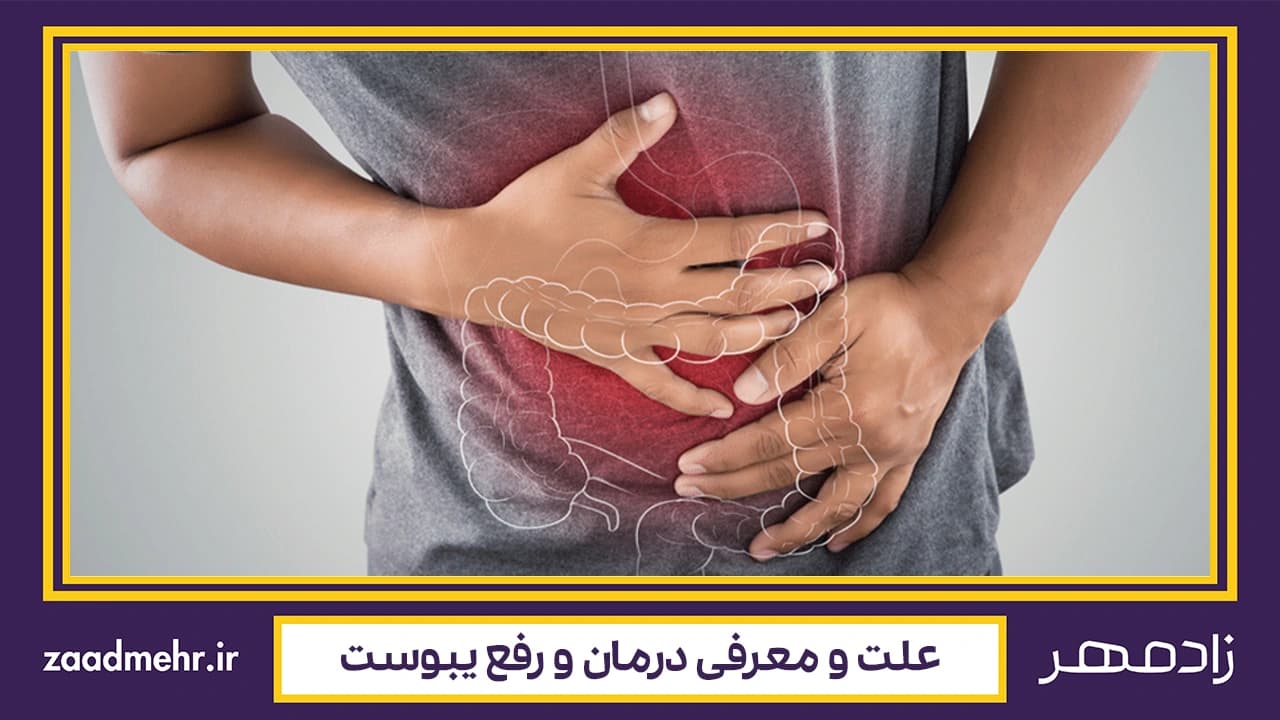 چرا یبوست گرفتم؟ روش‌های درمان یبوست