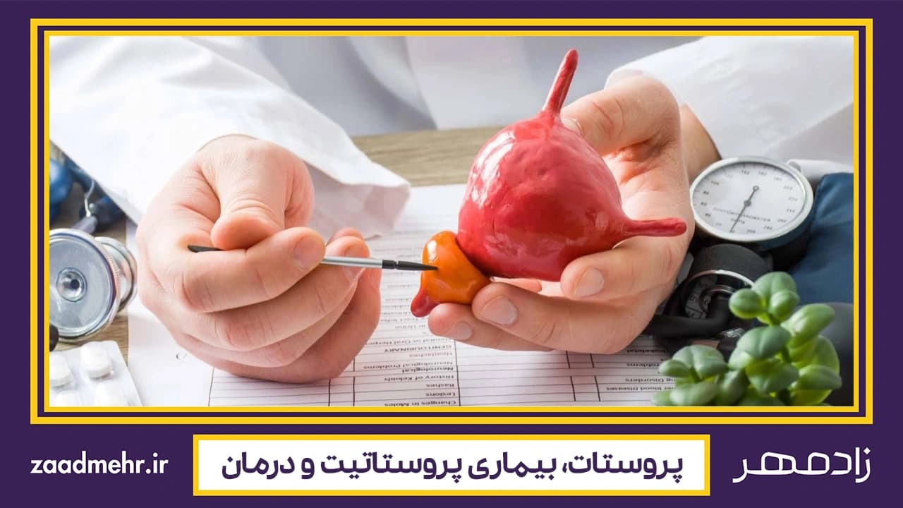 پروستات چیست؟ انواع روش‌های درمان