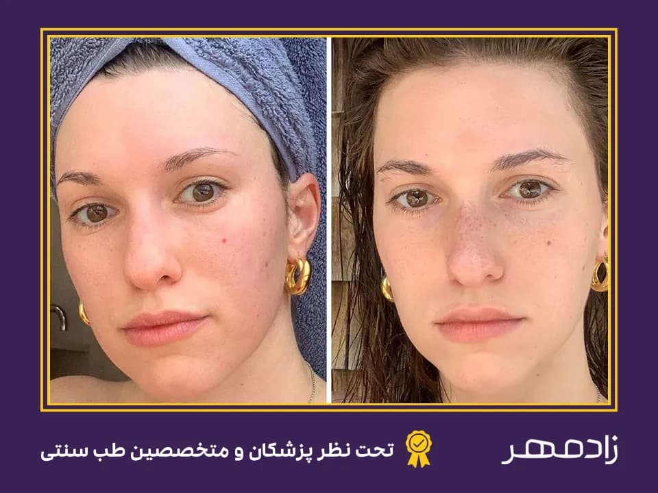 Before and after using natural oils for eyebrow growth - قبل و بعد از استفاده از روغن‌های طبیعی برای رشد ابرو