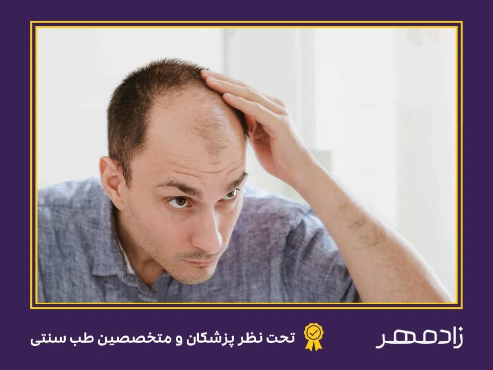 ریزش مو از جلوی سر - Hair loss from front