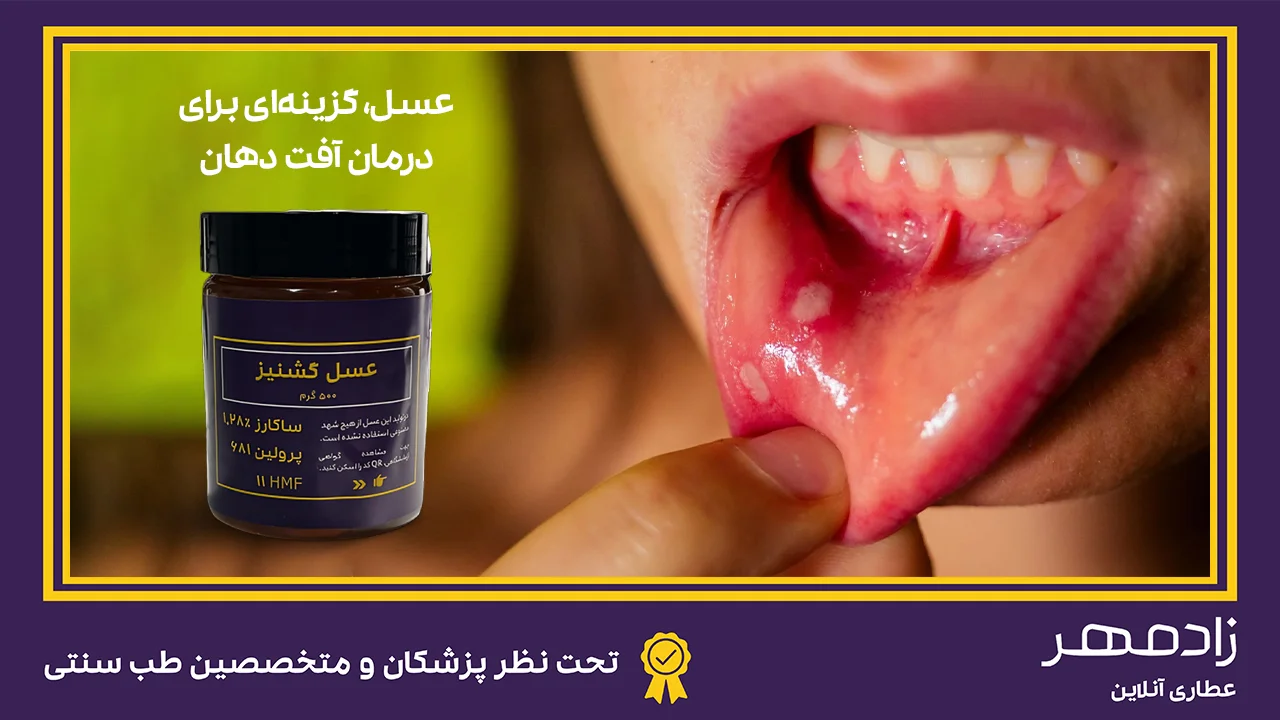 عسل برای درمان آفت دهان - Honey for canker sores treatment