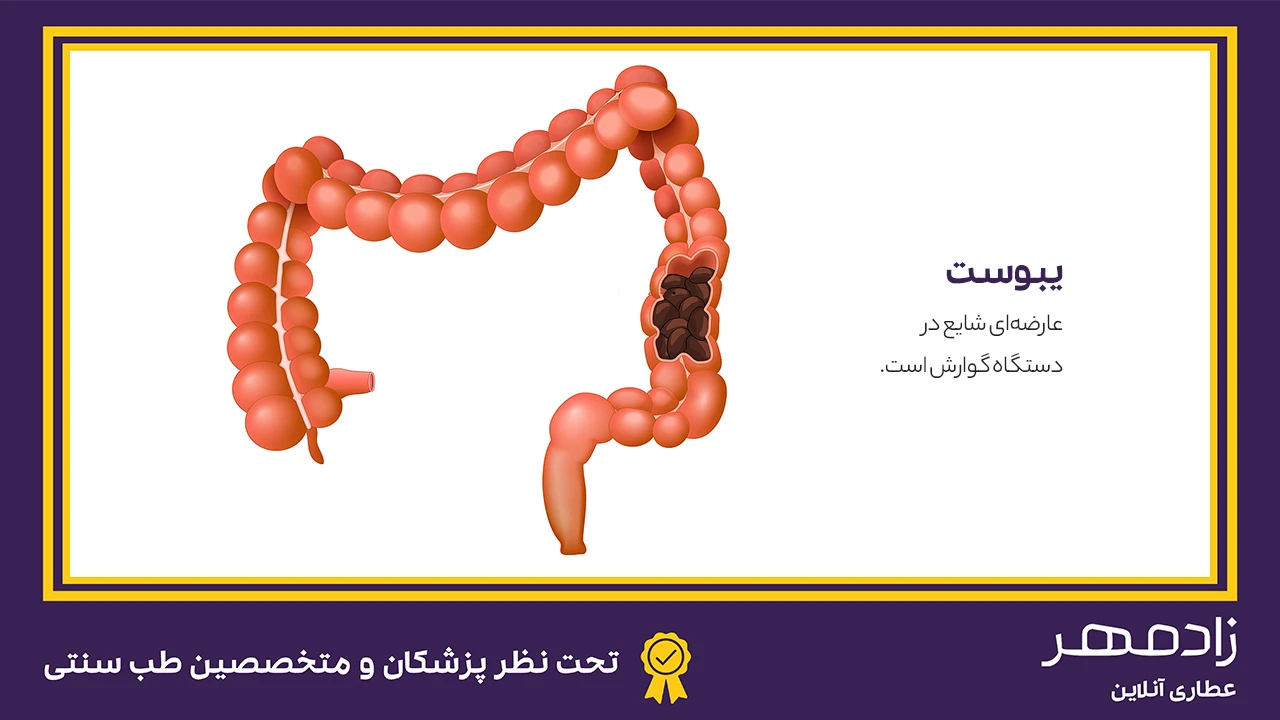 یبوست چیست؟ - What is constipation