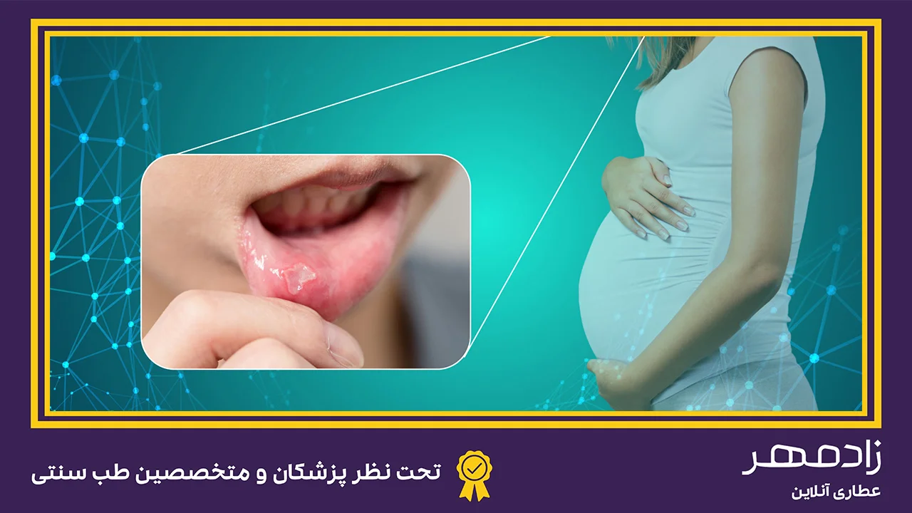آفت دهان در بارداری - Canker sores in pregnancy