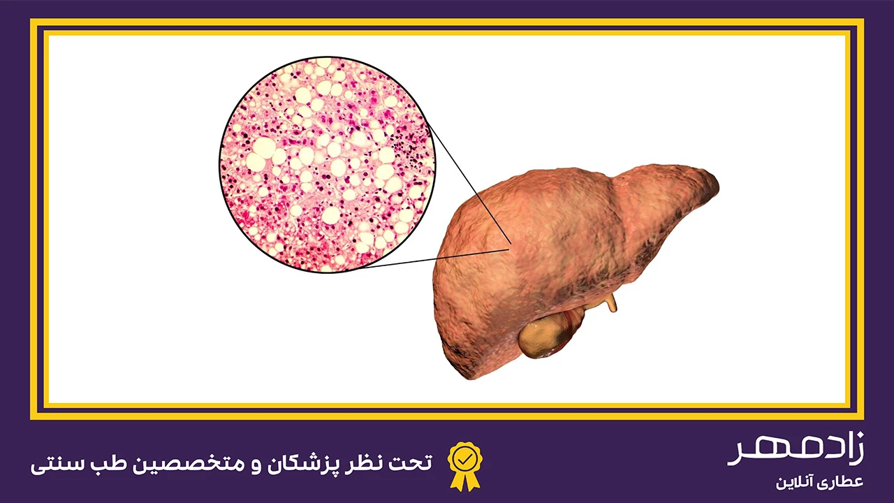 کبد چرب دارای گریدهای مختلف می‌باشد - Fatty liver has type of grades