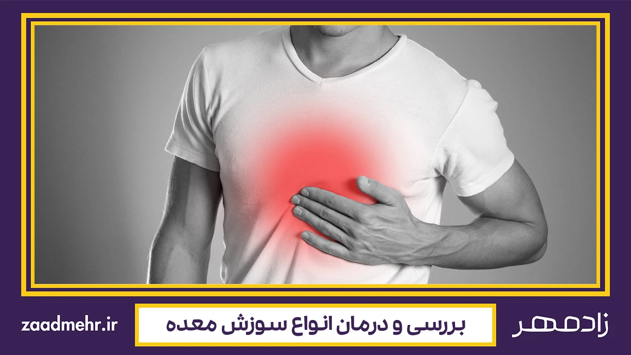 درمان سوزش معده - Heartburn treatment