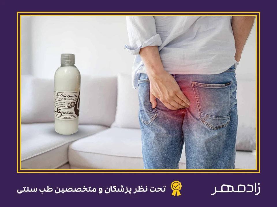 درمان بواسیر با روغن نارگیل - Hemorrhoid treatment with coconut oil