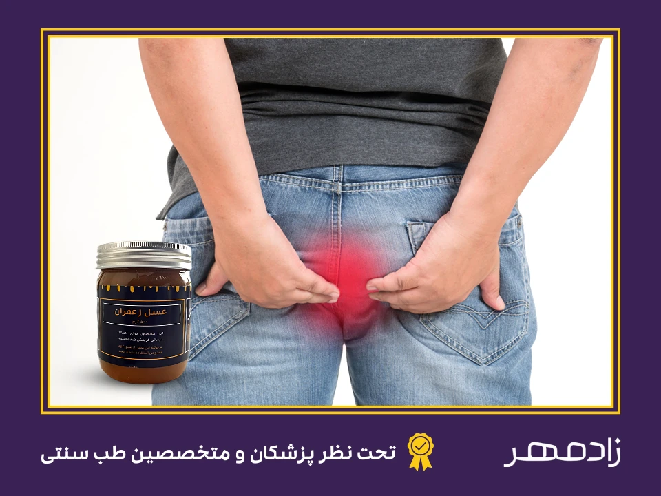 استفاده از عسل برای درمان بواسیر - Hemorrhoid treatment with honey