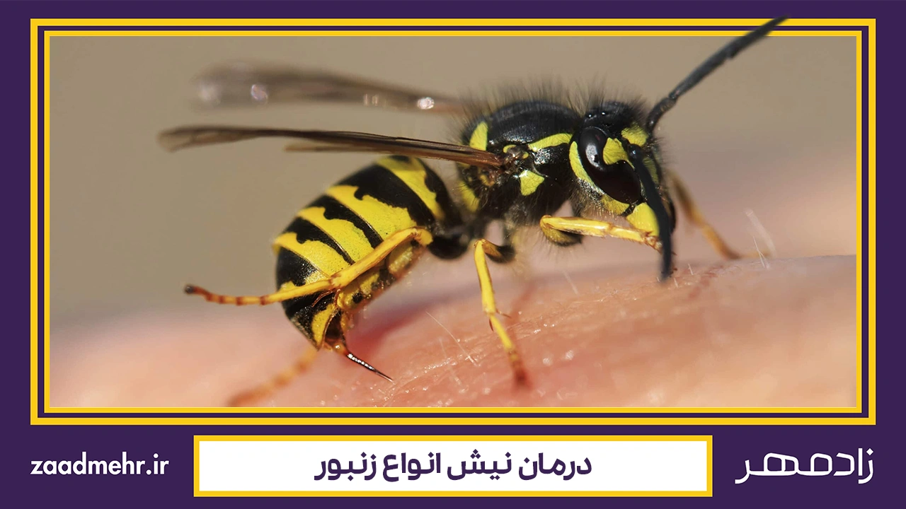 درمان نیش زنبور - Bee sting treatment