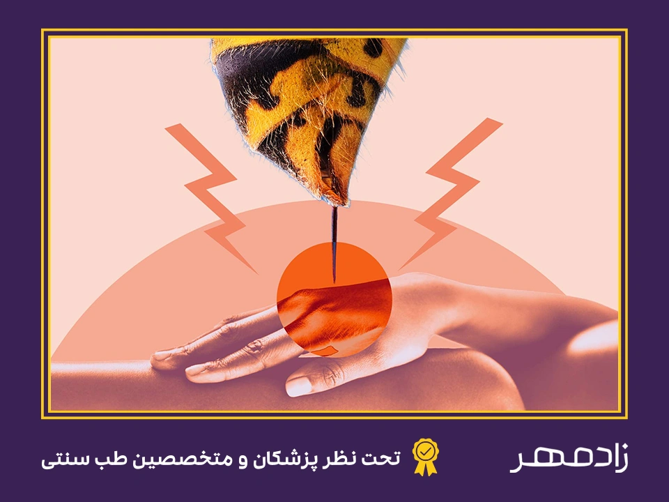 خطرات نیش زنبور - Dangerous bee sting