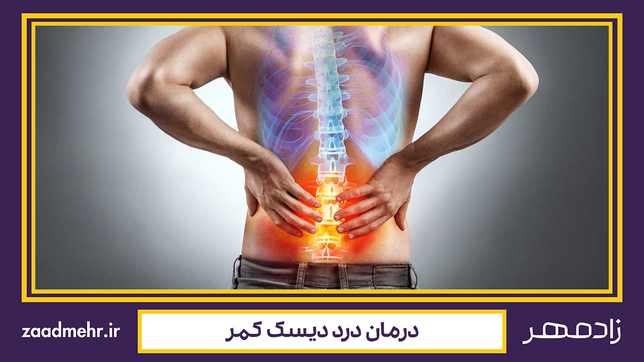 درمان دیسک کمر - Lumbar disc treatment