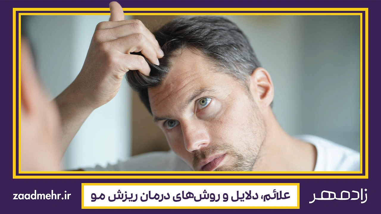 ریزش مو - Hair loss