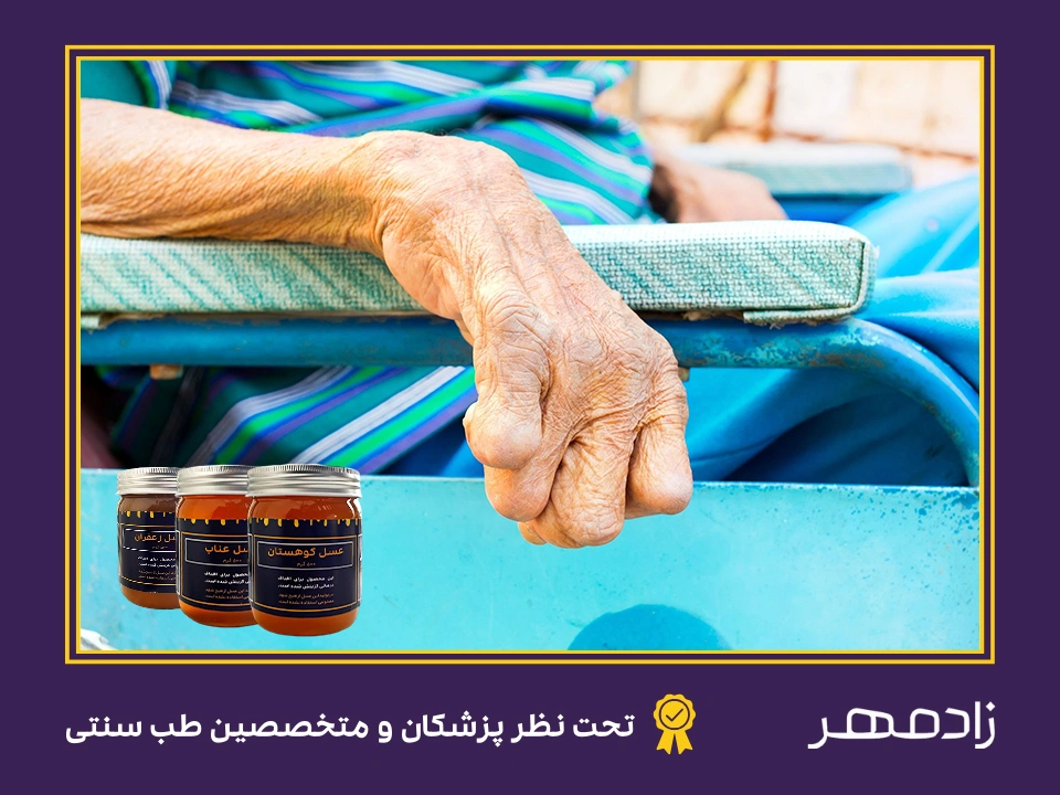 عسل برای بیماری جذام - Honey for leprosy disease