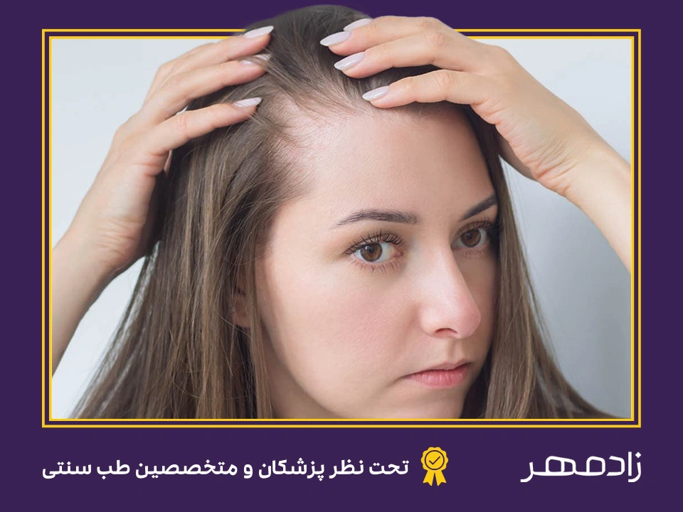 بیماری آلوپسی - Alopecia disease