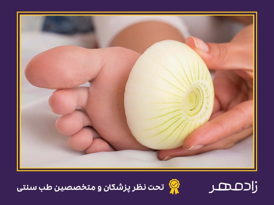 درمان تب با گذاشتن پیاز روی کف پا - Onion on feet for fever treatment