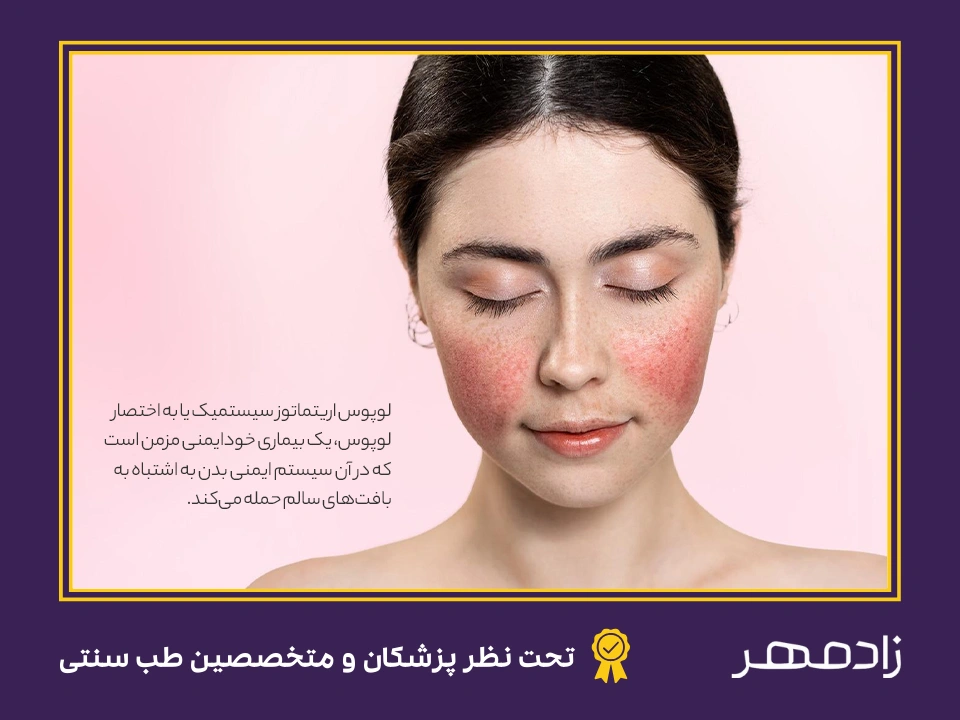 بیماری لوپوس چیست؟ - What is lupus disease?