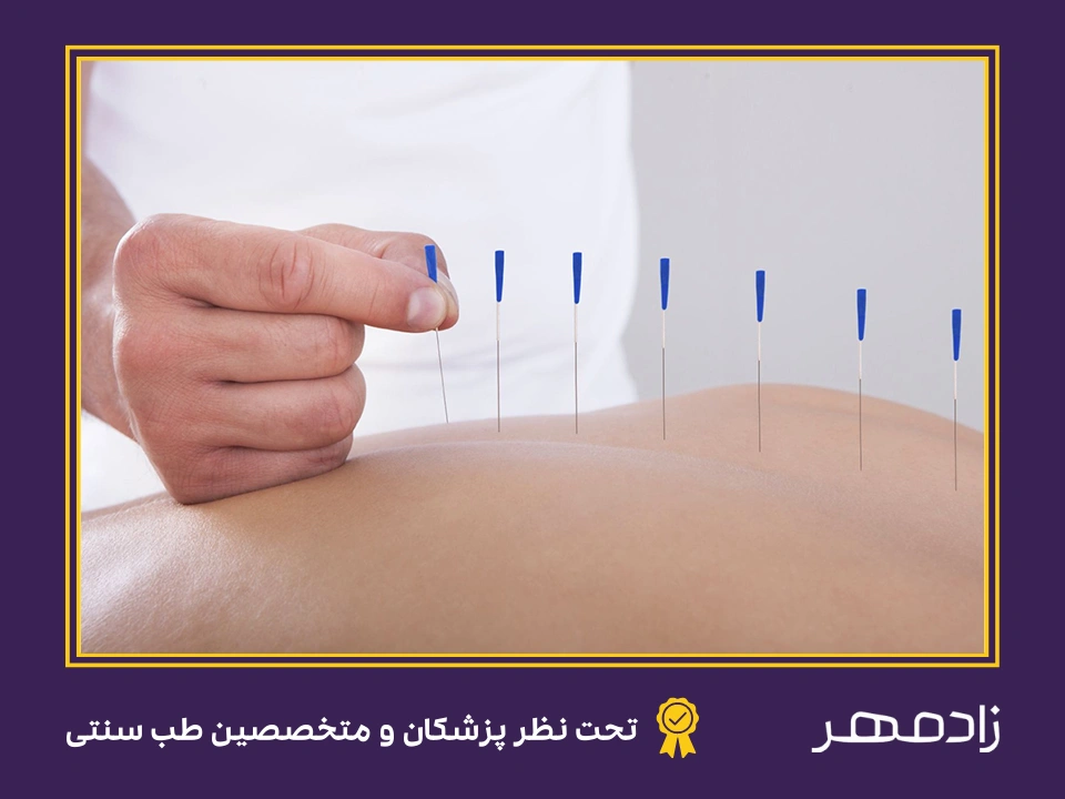 تغییر در اشتها با طب سوزنی - Acupuncture for change appetite